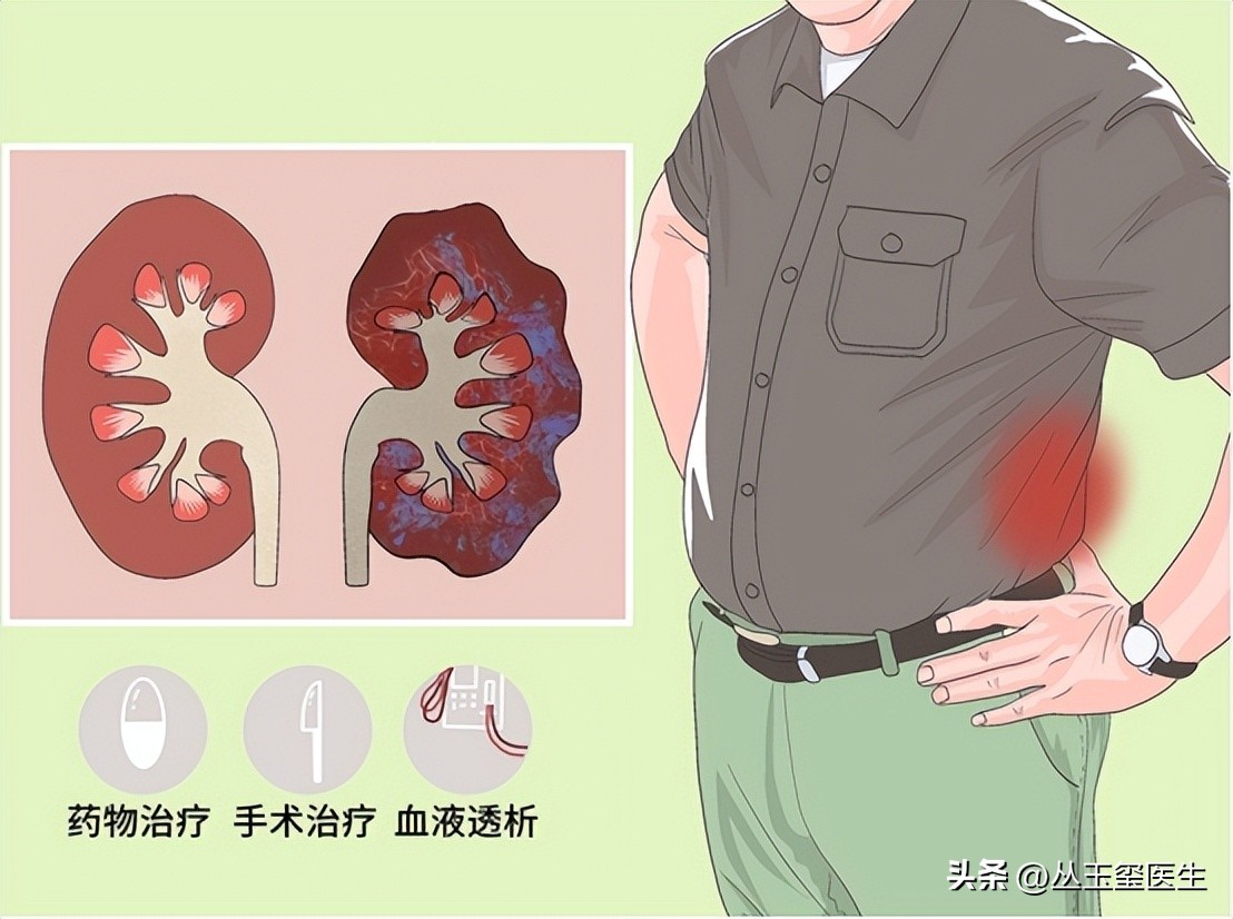早期慢性肾脏病患者的自我防护,慢性肾脏病3期治疗药物