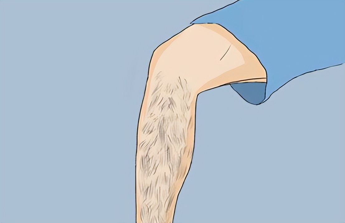 人的体毛旺盛是因为什么,为什么人的体毛多