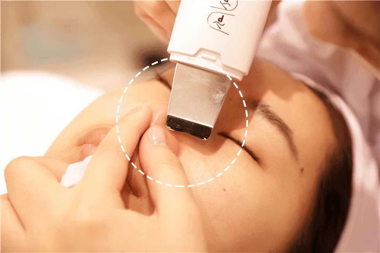 去鼻子上的黑头最好的方法,去鼻子上黑头的有效方法