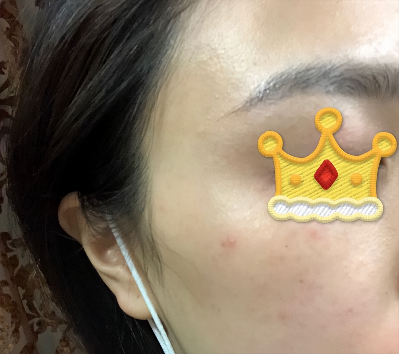 花漾缘面膜,花漾缘祛痘清洁面膜