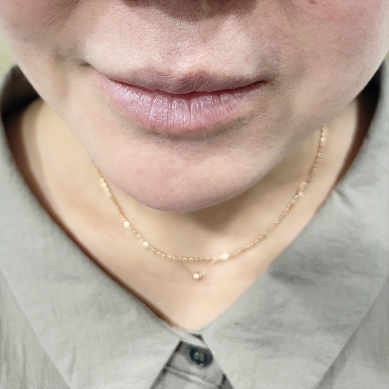 「56岁的陈女士」面部提升真实经历，术后15天效果很惊艳