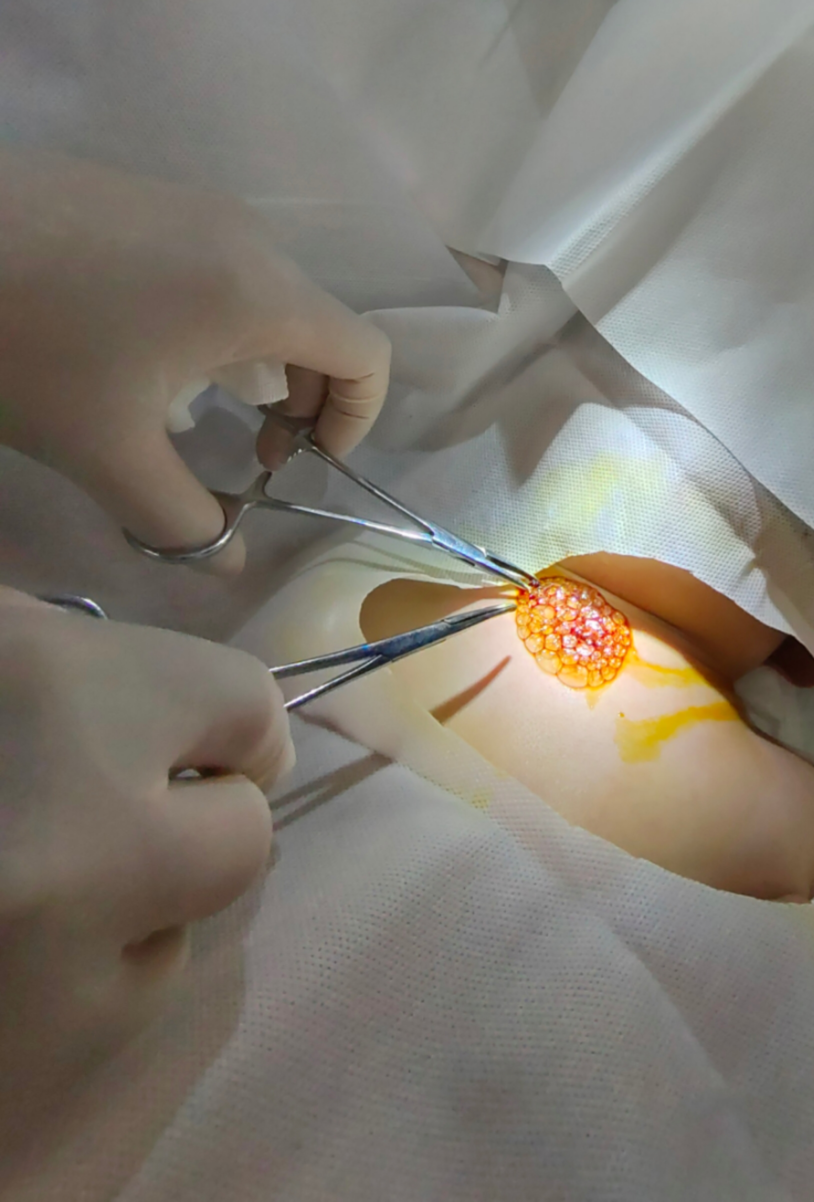 一颗花生米差点要了孩子的命,一颗花生引发的悲剧