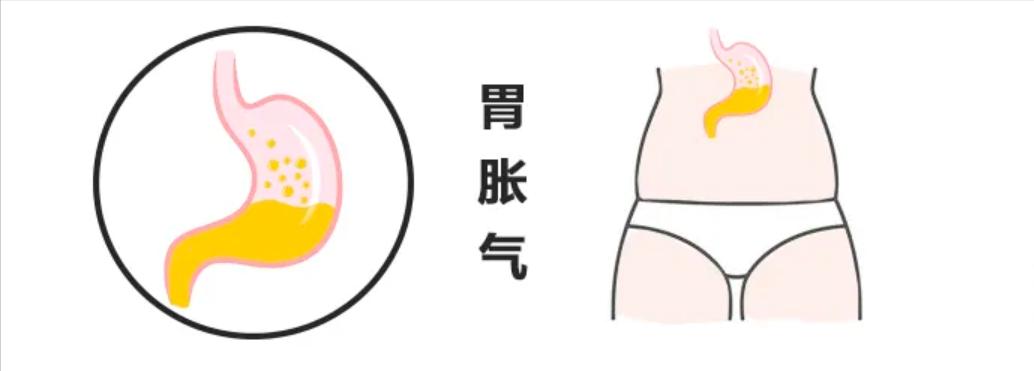 教你2招快速缓解胀气,怎样快速解除胃肠胀气