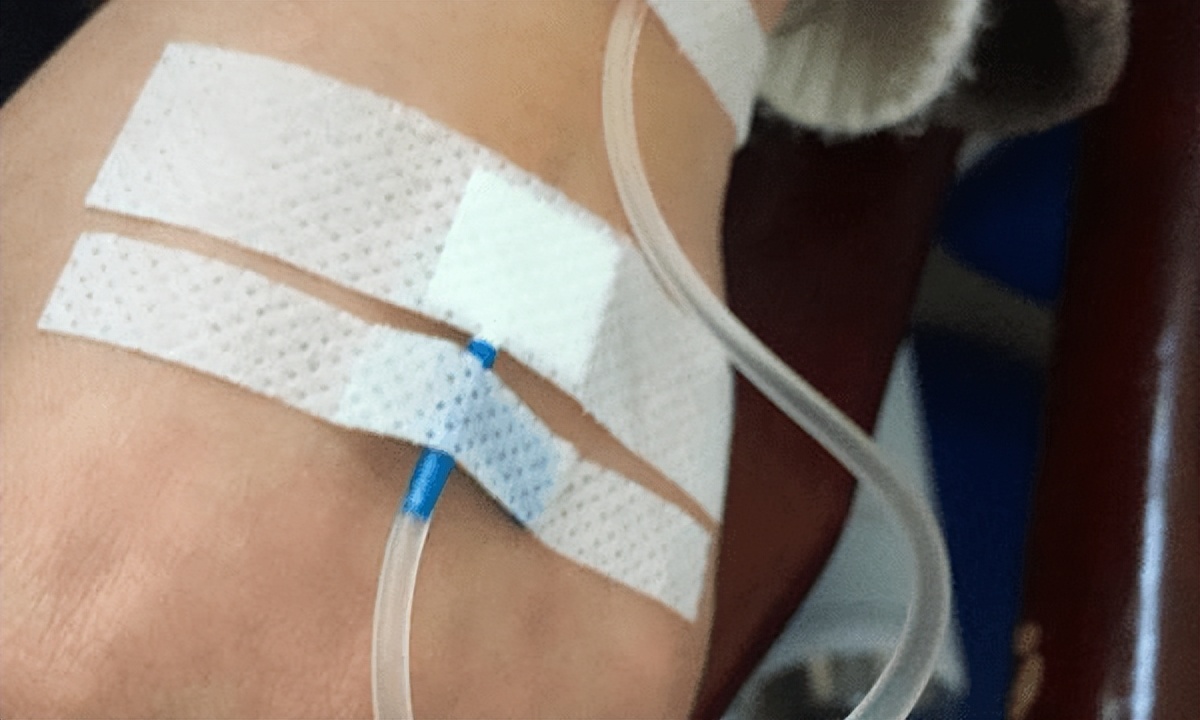 植骨是怎么一回事,植骨的原理是什么