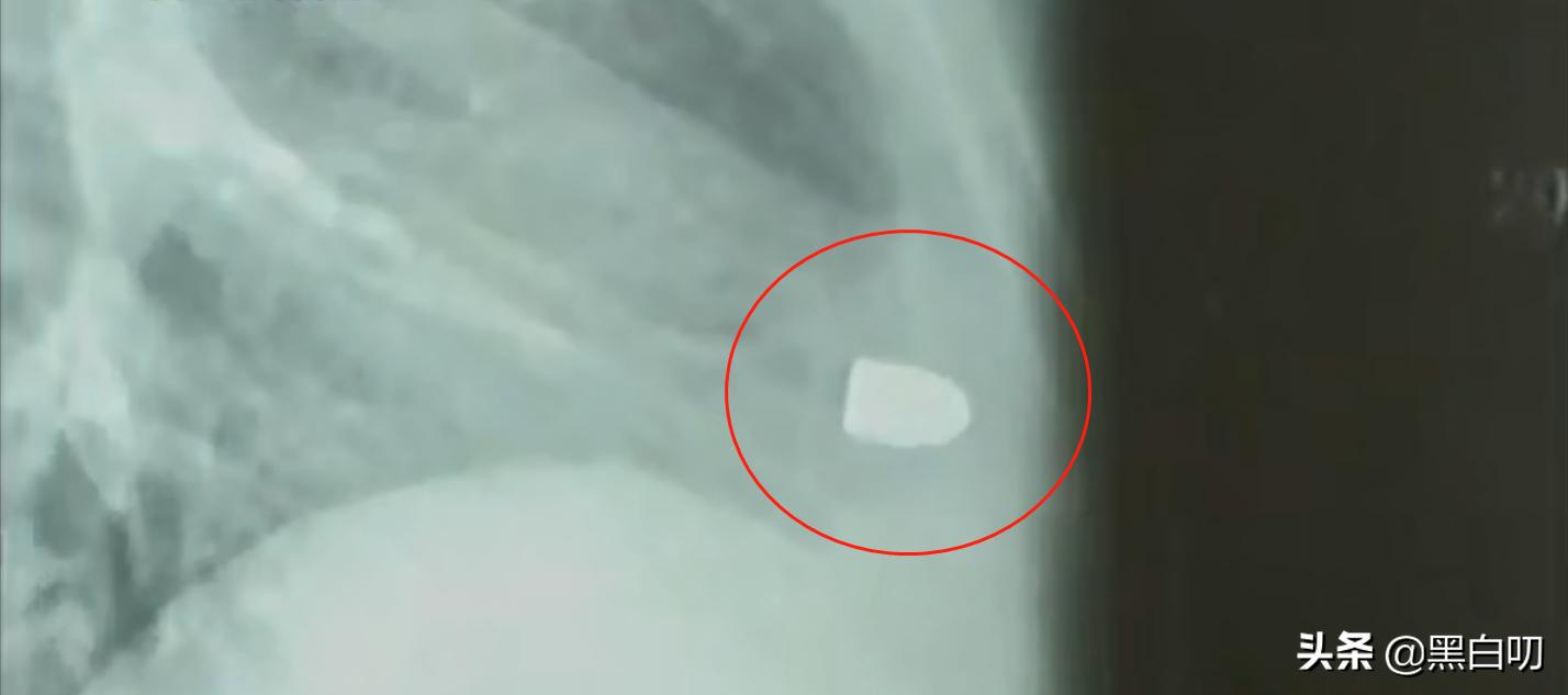 男子心脏不舒服不去医院,心脏不舒服去医院怎样查