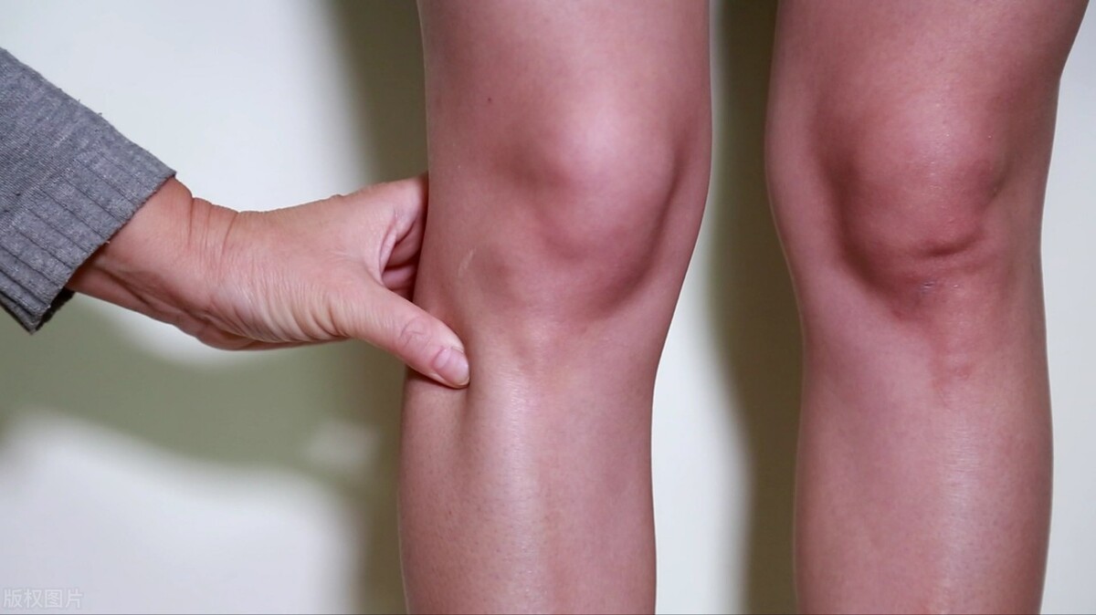 轻微的膝内翻怎么治,后天性膝内翻怎么治疗