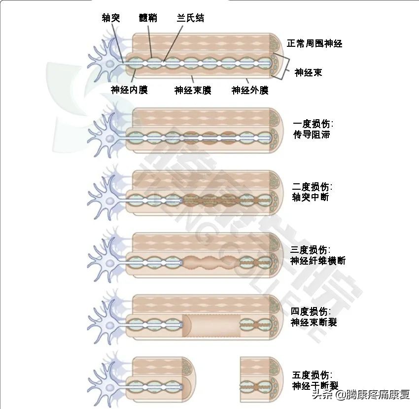 胳膊与肩膀相连处疼痛是什么原因,左胳膊上臂疼痛是什么原因造成的