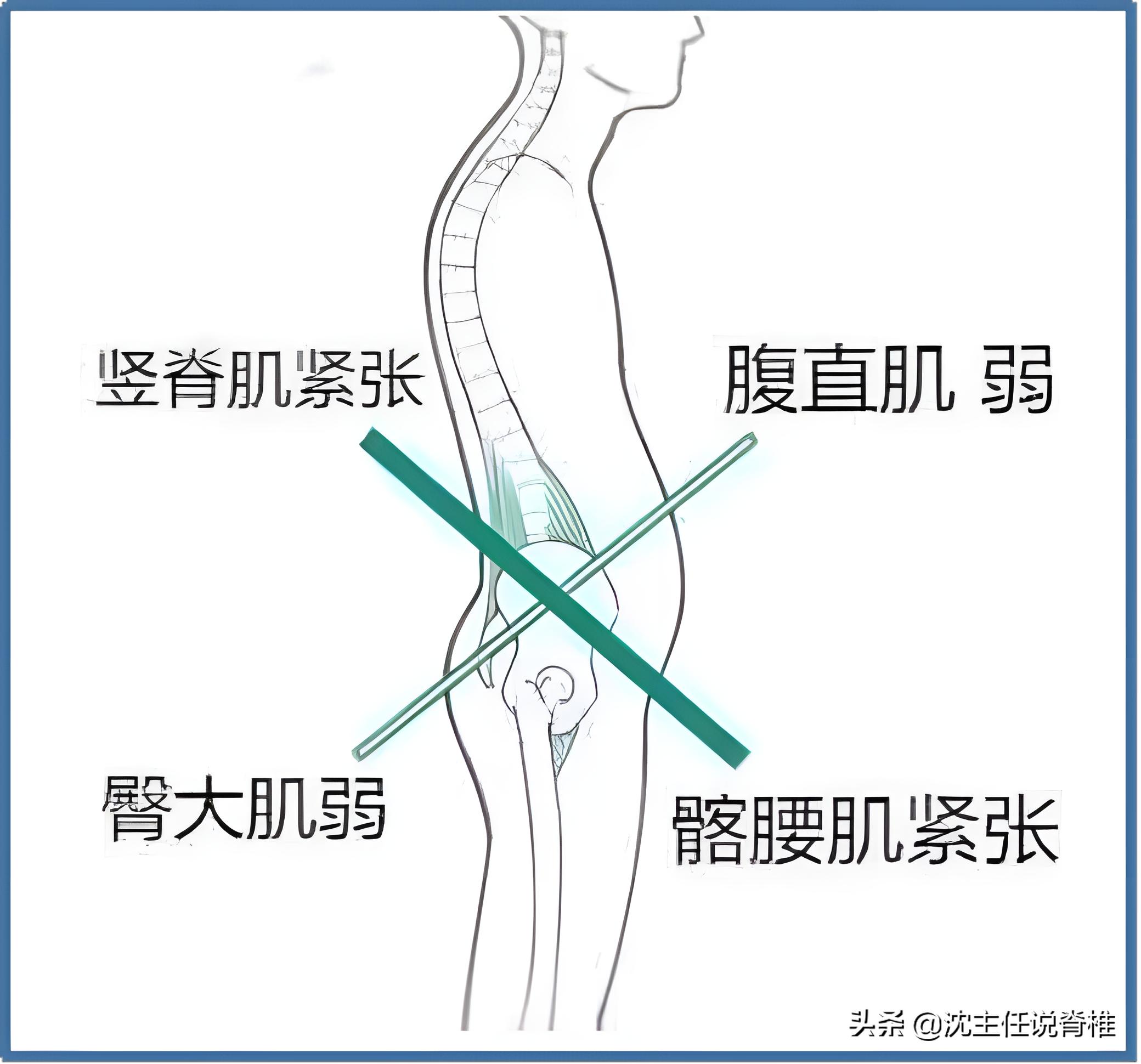 人不胖但肚子变大是怎么回事,肚子大怎么练都不小怎么回事