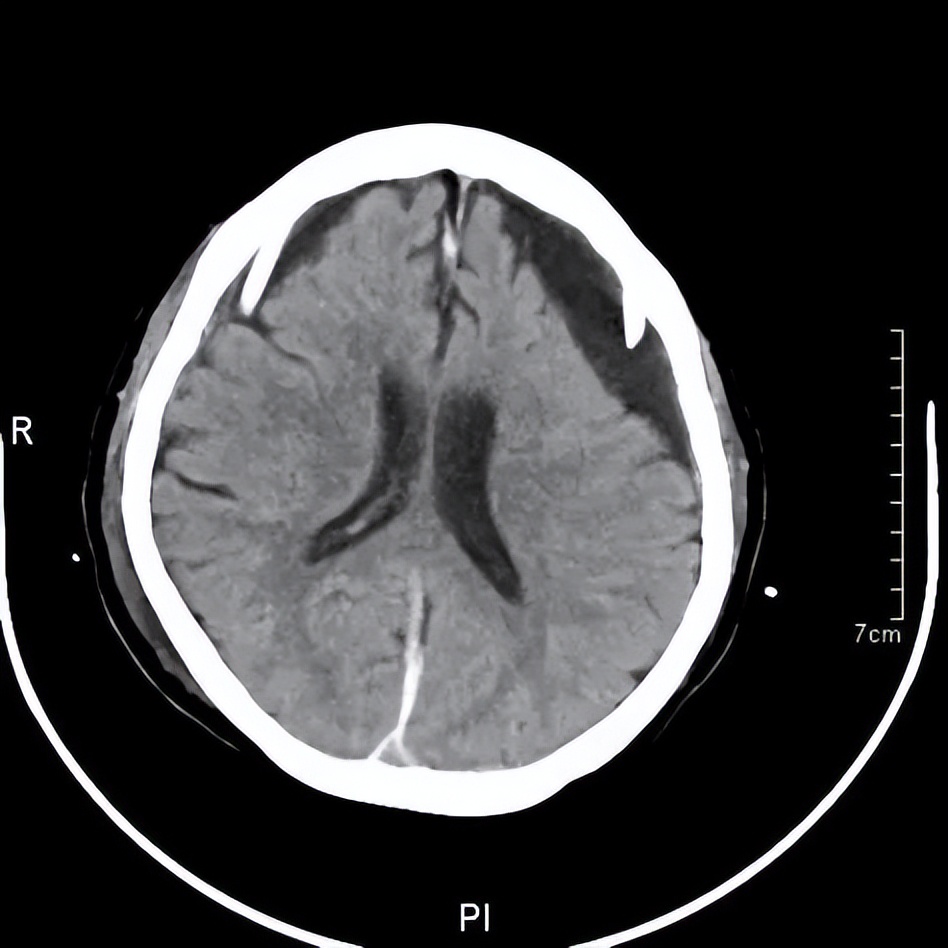 记忆门诊深圳,记忆门诊诊疗流程