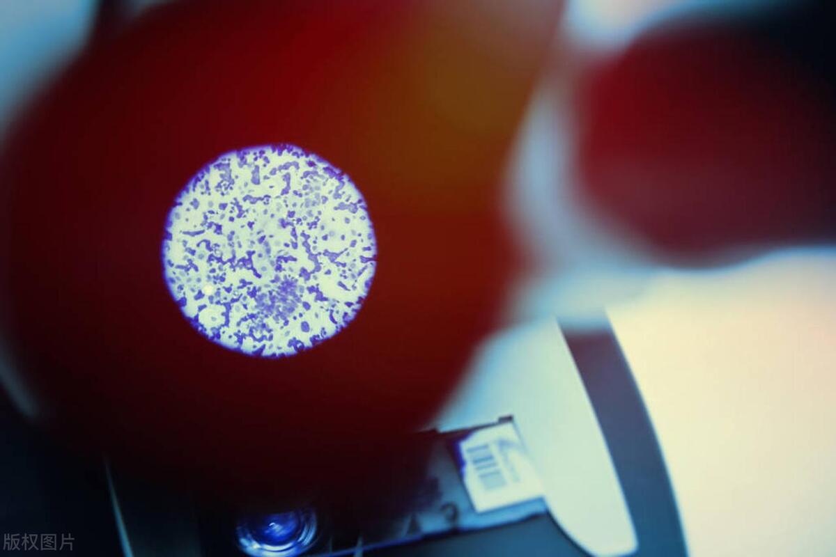 性病也有潜伏期？揭秘这5种常见性病的潜伏期，做好预防很重要