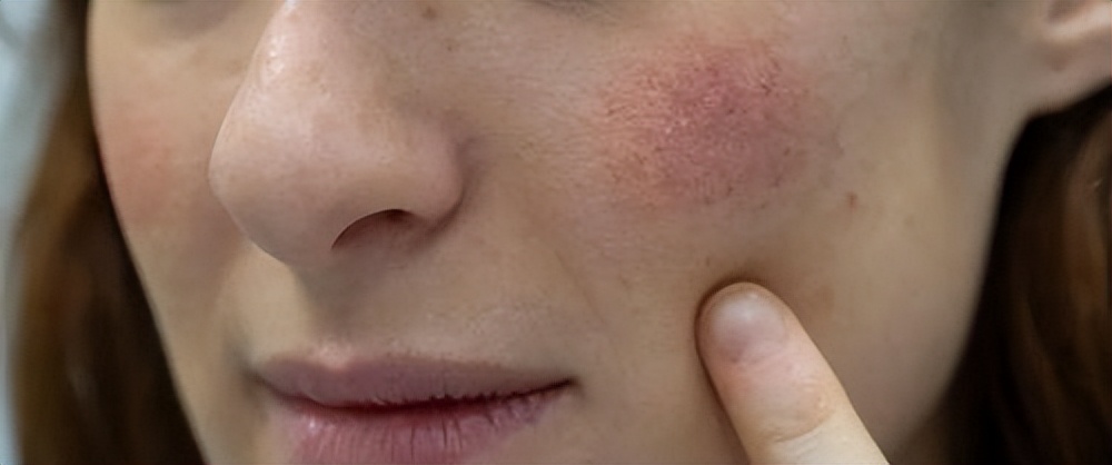 为什么明明敷了面膜，肌肤却越来越干？很可能是忽略了这个小细节