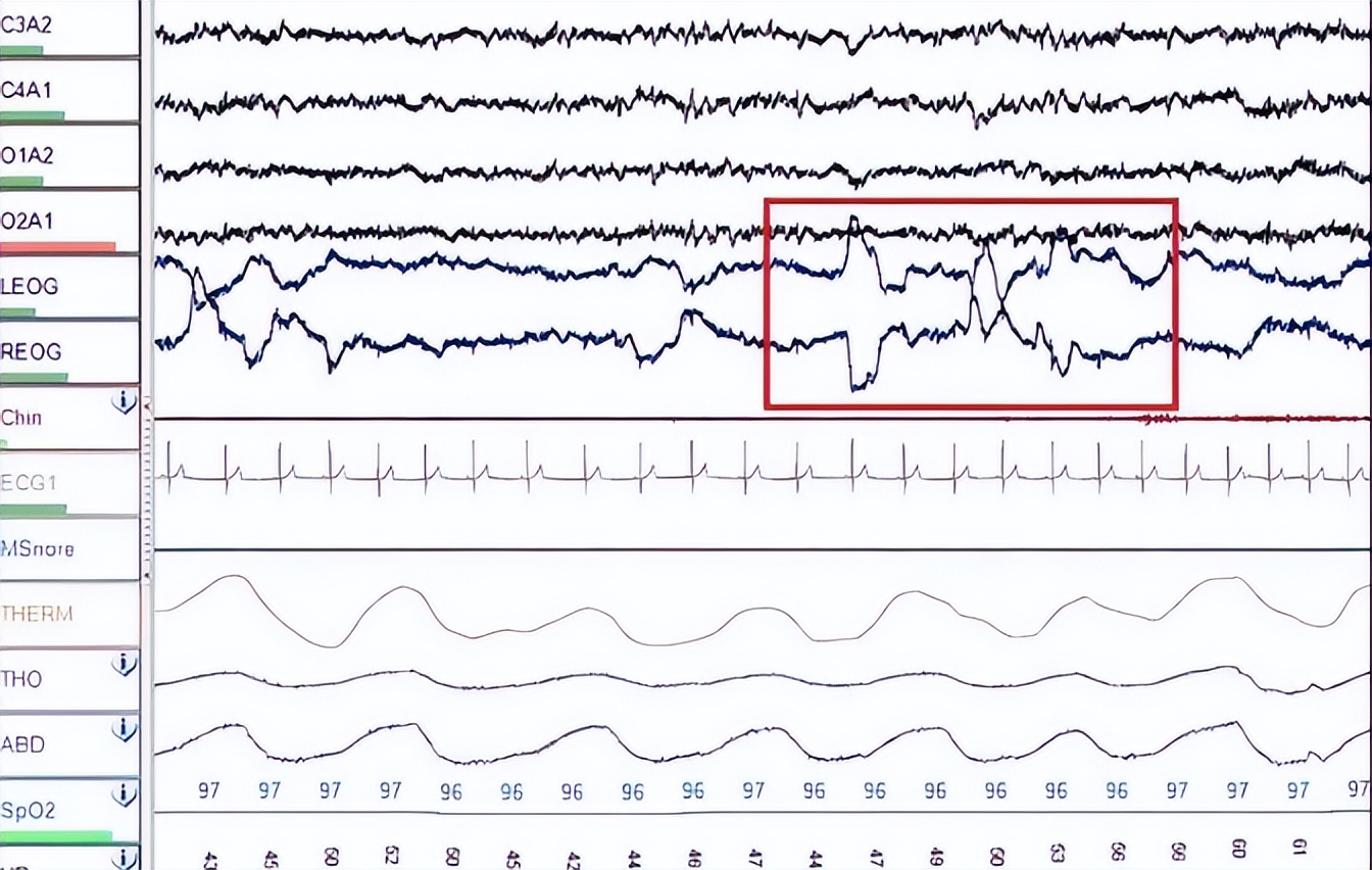 河南农妇40年不睡觉是真的吗,河南一女子竟然能40年不睡觉