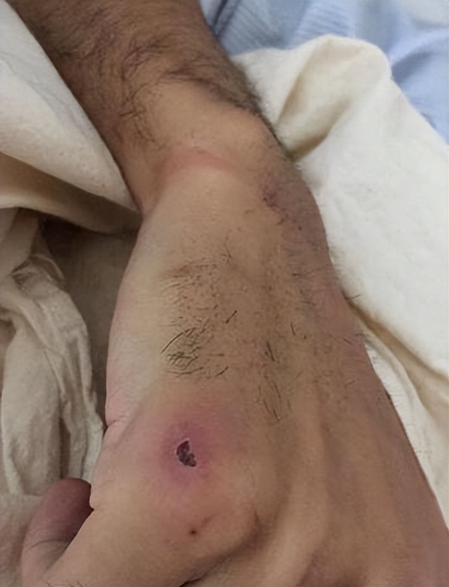 勒索殴打中国游客，公然张贴“禁止中国人进入”，如今报应来了