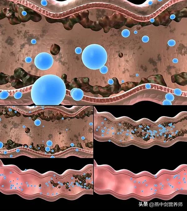 喝冷水就拉肚子是有虫子吗,喝冷水就拉肚子是胃寒吗