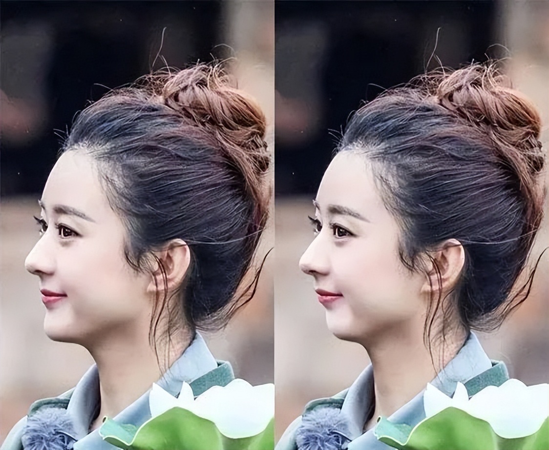 下巴后缩是不是最难看的,下巴后缩明星怎么改善