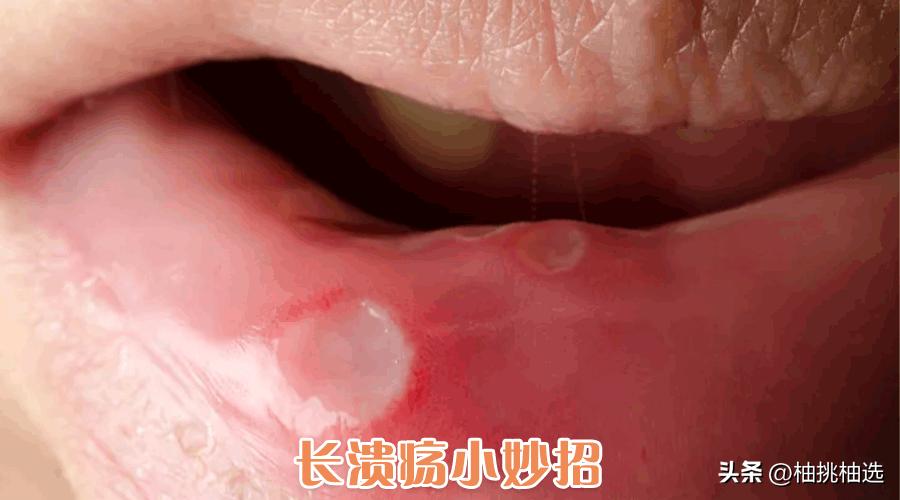 不要钱的生活小妙招,不花钱的王炸生活小妙招