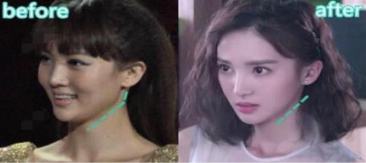 有一种倔强叫做没整容,有种倔强叫不承认整容