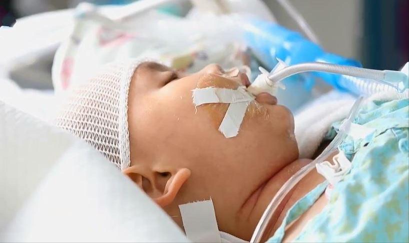 8岁儿童脑部肿瘤的症状10大前兆,儿童脑肿瘤手术得多长时间