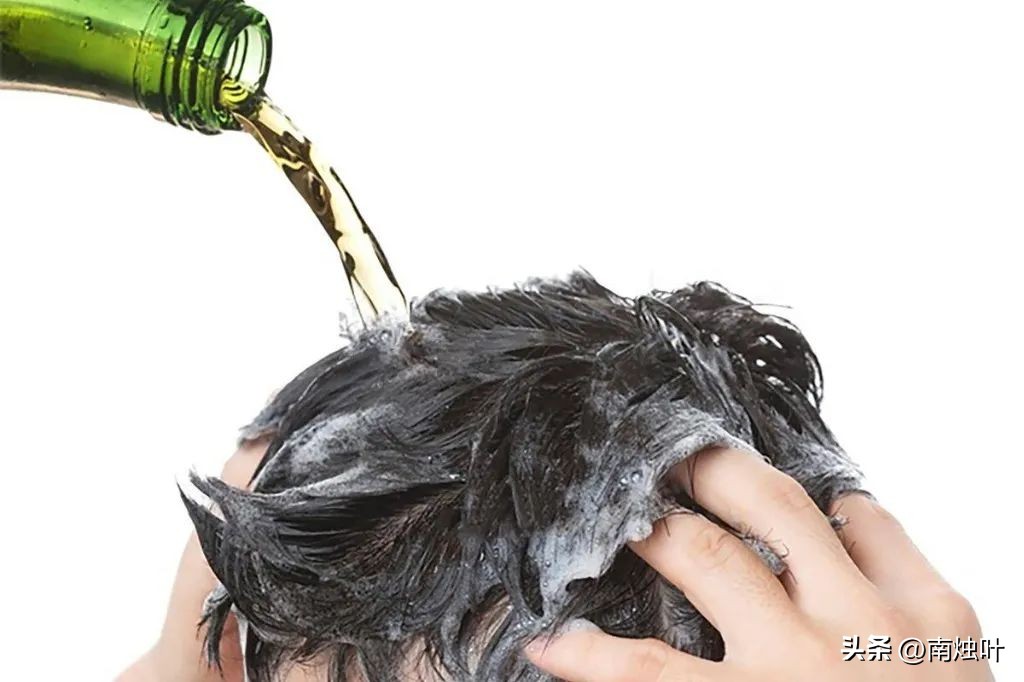 头油头痒头屑掉头发怎么治疗,头屑多头皮痒油头有什么好妙招