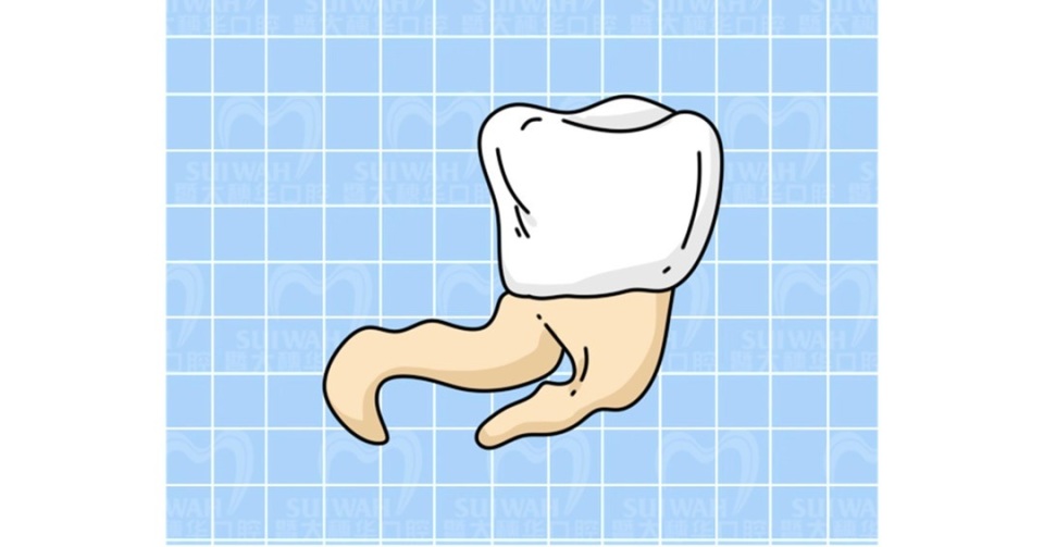 根管治疗为什么只要400块,有多少人接受过根管治疗
