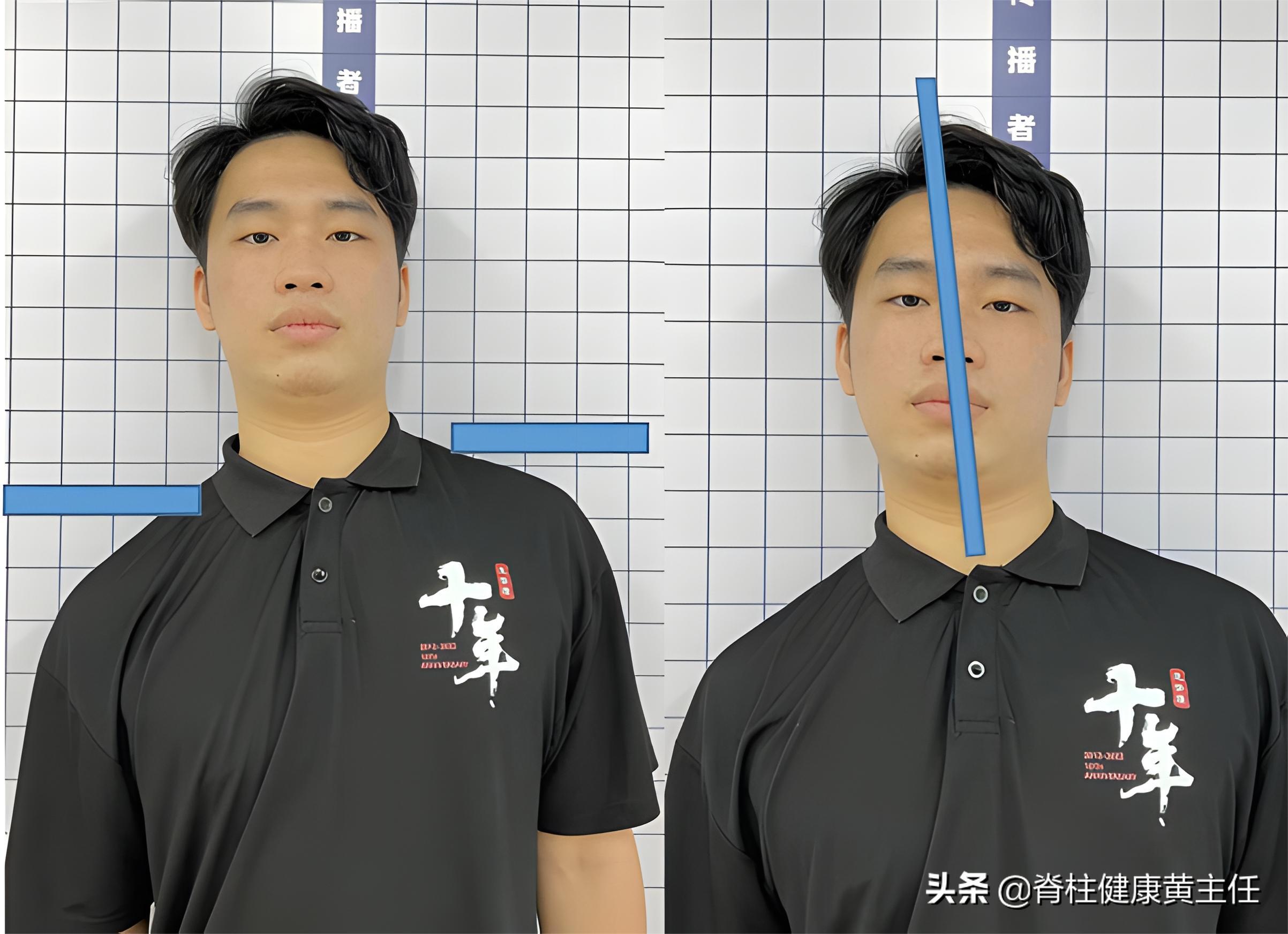 颈椎酸怎么办快速缓解疼痛,颈椎感觉酸乏吃什么药