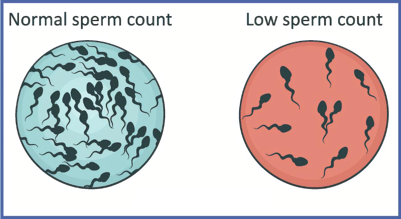 因为过度肥胖导致睾丸发育,睾丸发育与肥胖有关吗