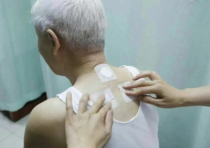 过敏性鼻炎哮喘综合征,过敏性鼻炎诱发哮喘的进程