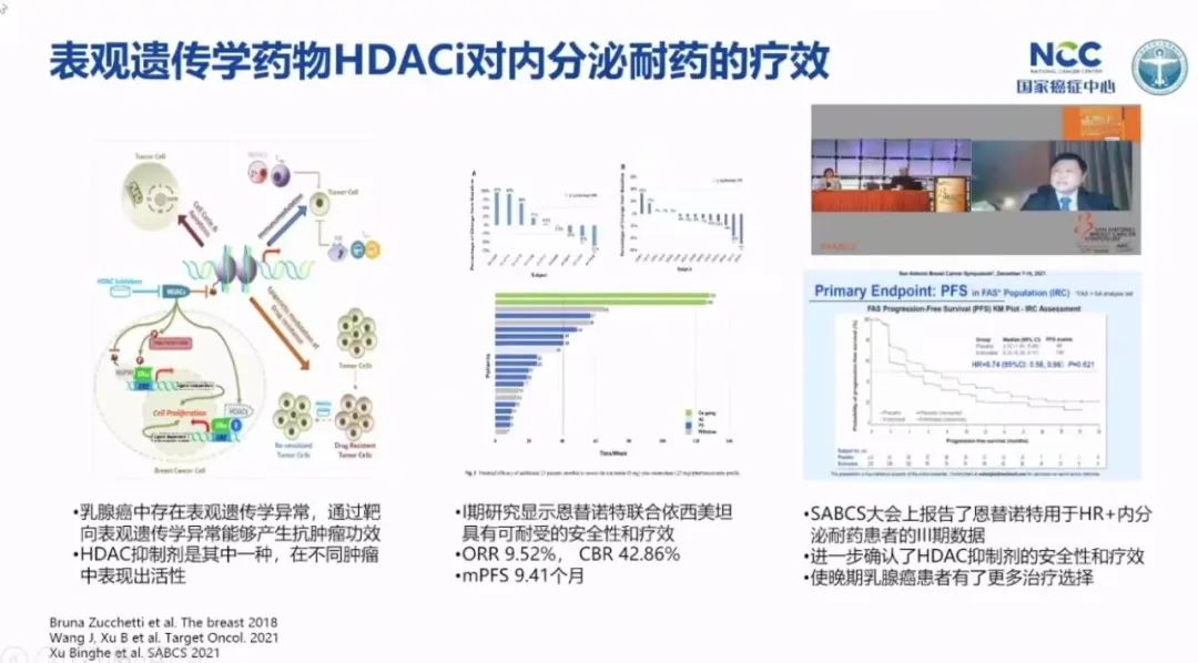 乳腺癌攻克,徐兵河乳腺癌晚期生存期