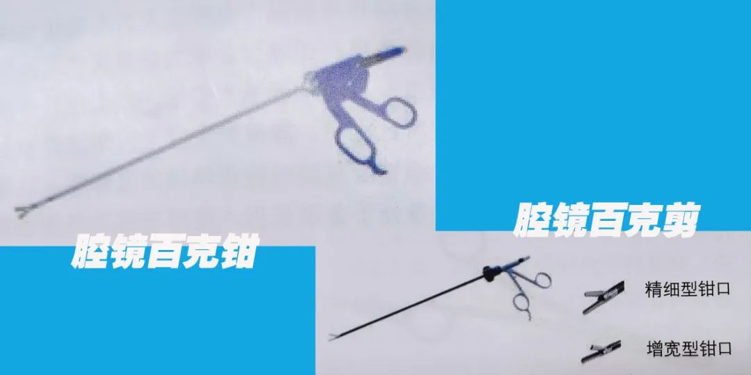 电外科技术在妇科手术的应用