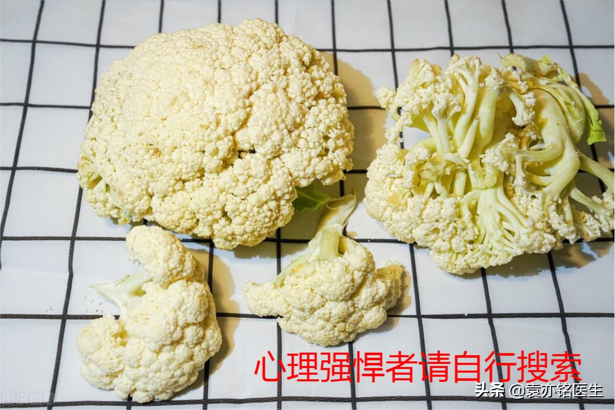 尖锐性湿疣的初期珍珠疹,怎么识别珍珠疹和尖锐性湿疣早期