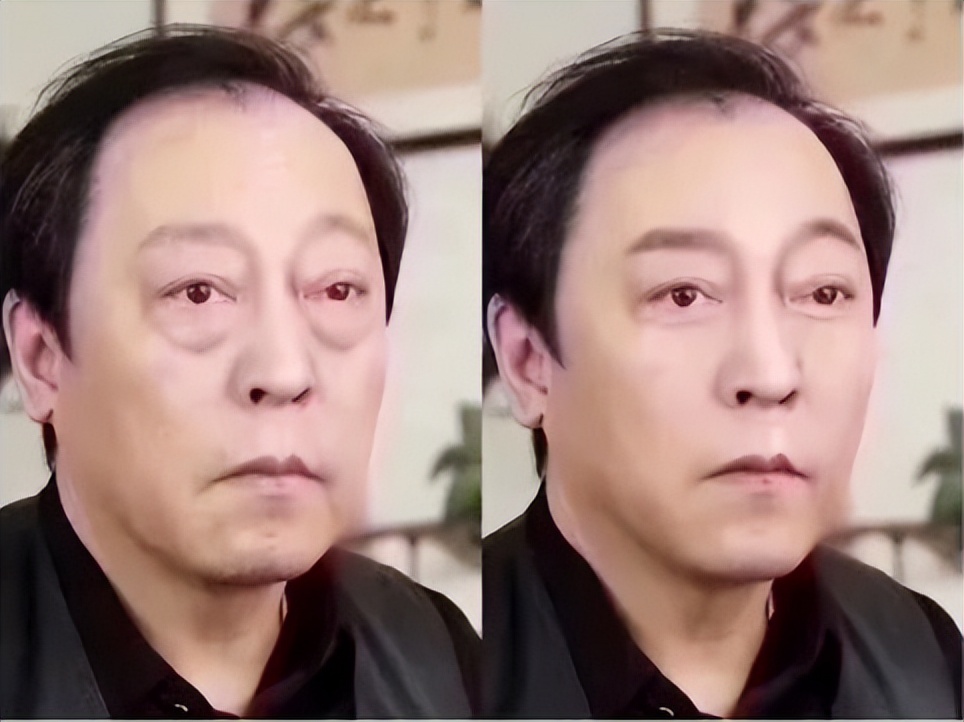 干货|拿什么拯救你，我的眼袋