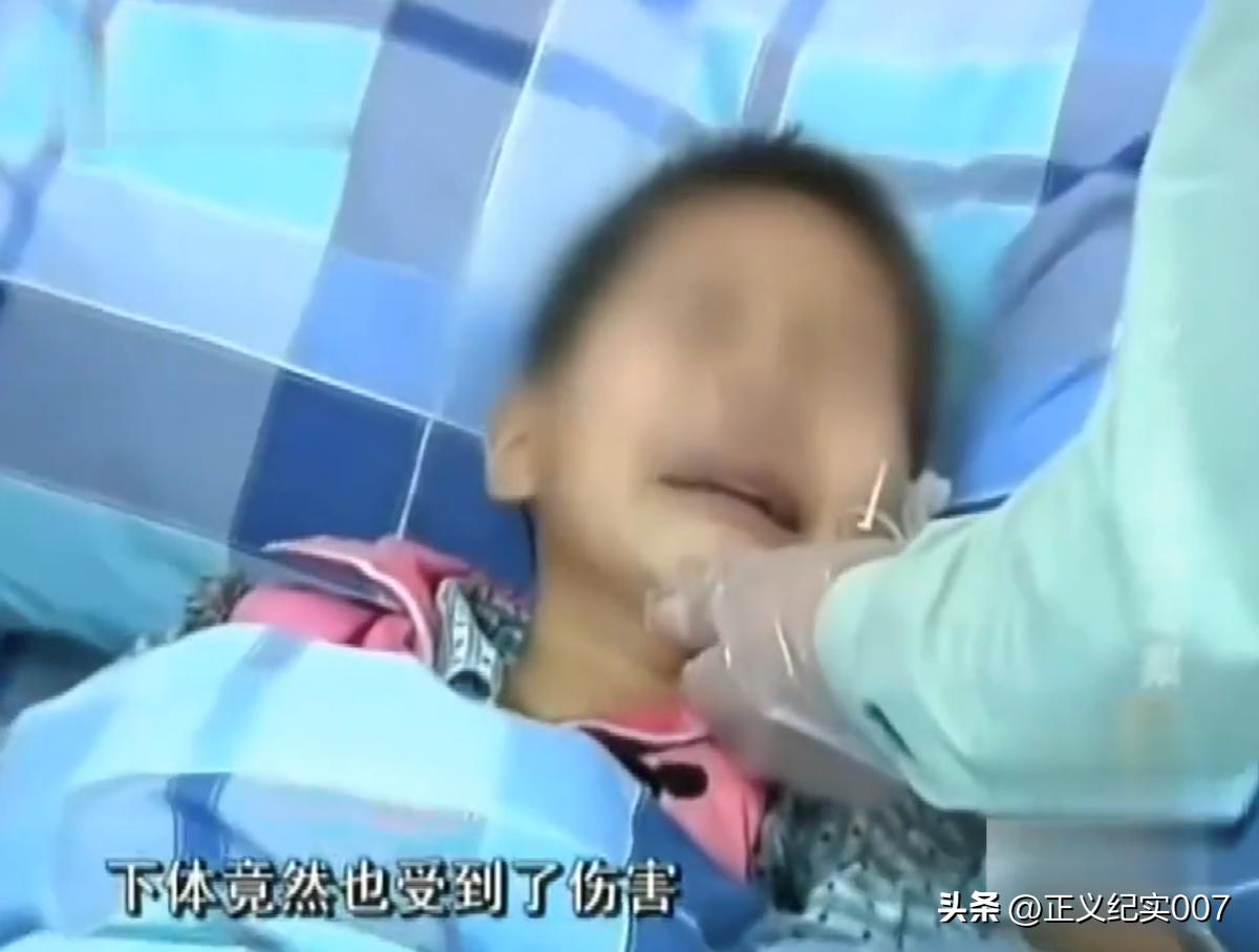 2010年广东省佛山市，残忍二妈捅伤六岁女童*体下**，砍掉手指跟耳朵