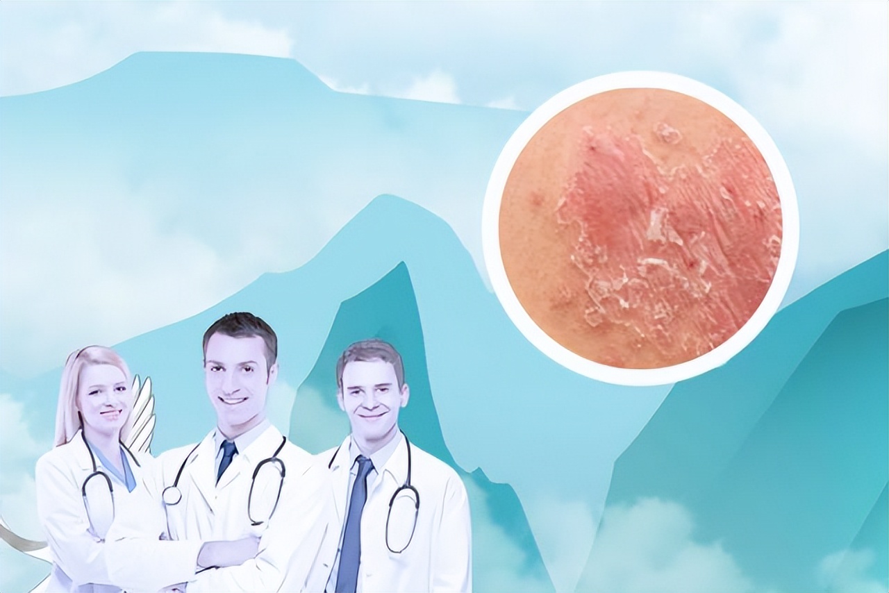 皮肤癣摸一下会传染么,顽固皮肤癣会传染吗