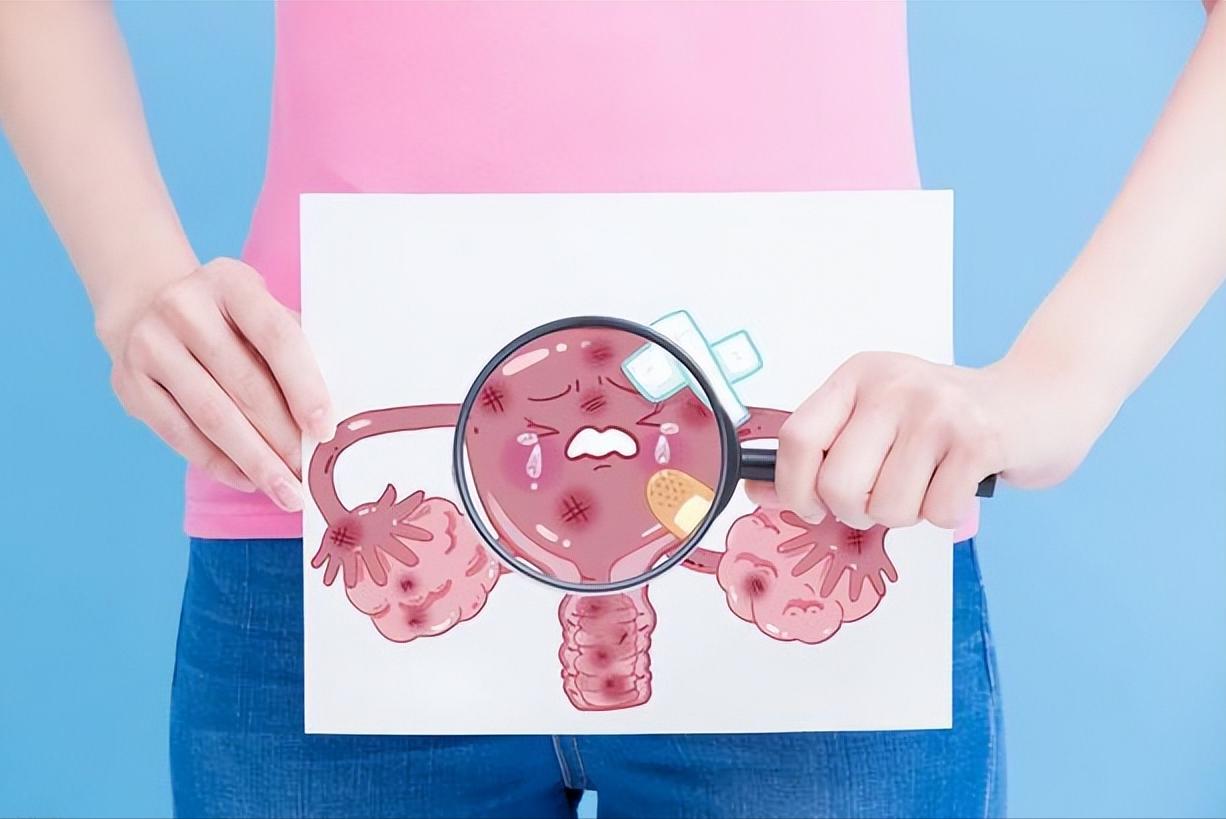 子宫内膜癌有哪些征兆,子宫内膜癌身体没有症状