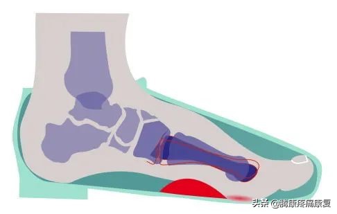 让脚变瘦的动作方法,有助于身体健康的动作