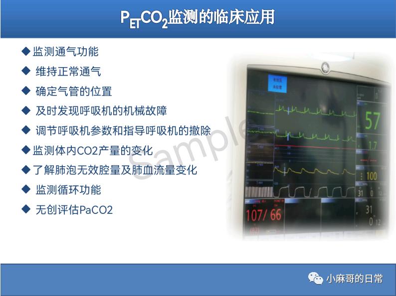呼气末二氧化碳检测图的解读,呼气末二氧化碳检测操作视频