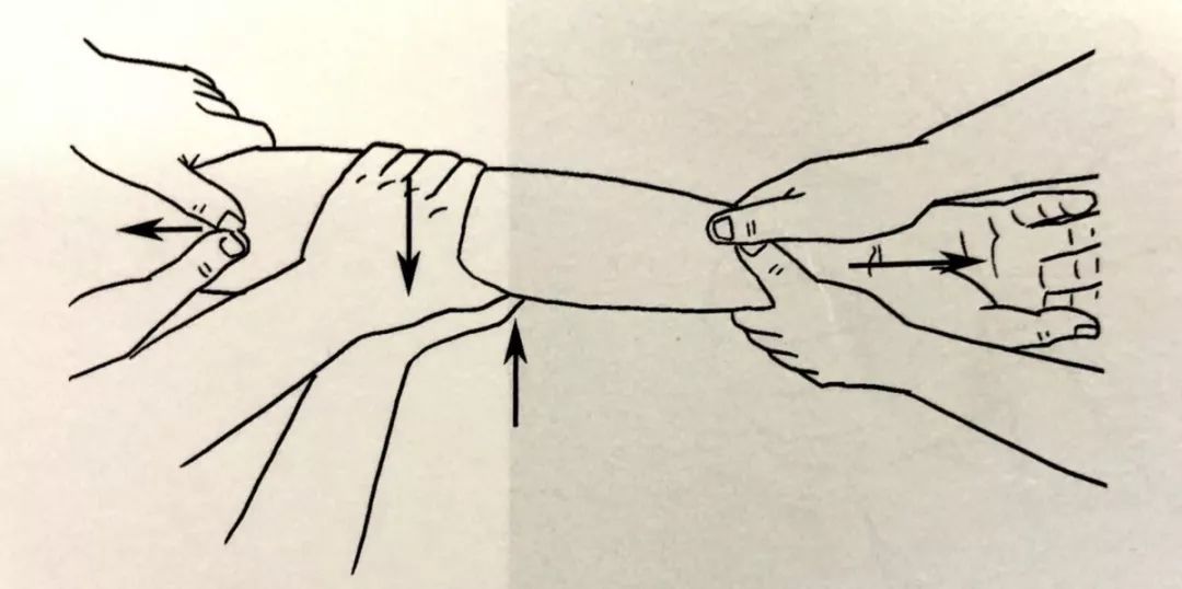 关节脱位的手法复位术操作步骤,关节脱位的手法复位