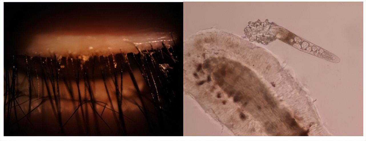 角膜接触镜验配案例图解,戴角膜塑形镜反复出现点染的原因