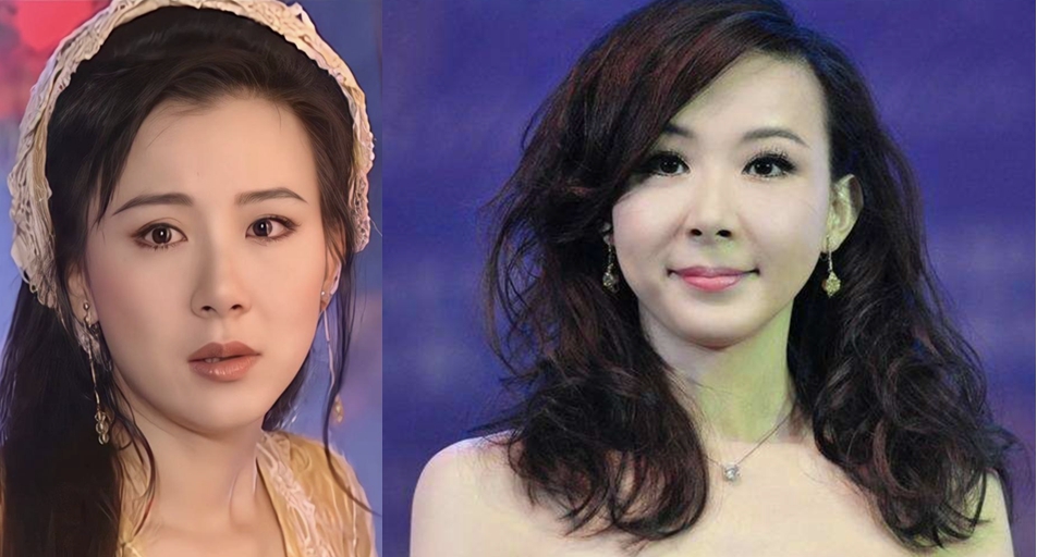 老演员整容脸变形,老年人整容前后照片