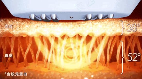 脸上到处是痘痘痘印痘坑怎么办,痘痘破了怎么处理不会留痘印痘坑