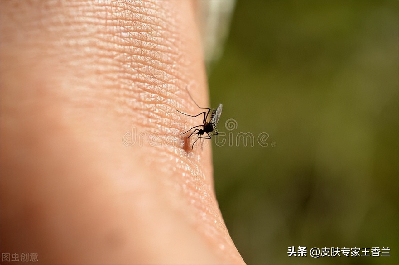 炉甘石洗剂治疗糖尿病皮肤瘙痒,炉甘石洗剂对皮肤瘙痒有效果吗