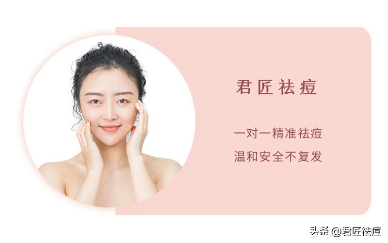 草本祛痘面膜粉有用吗正确使用草本祛痘面膜粉