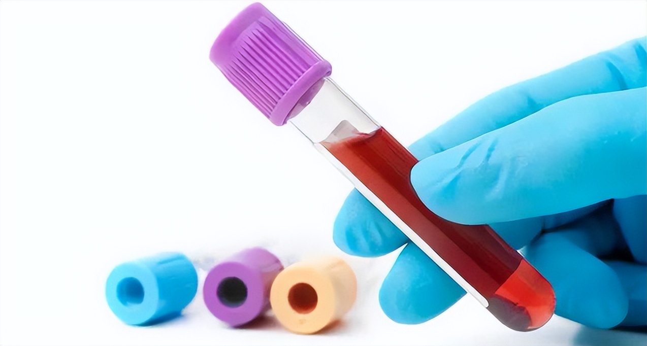 生物制剂治疗类风湿会诱发癌症吗,我的类风湿治愈经历及用药方案