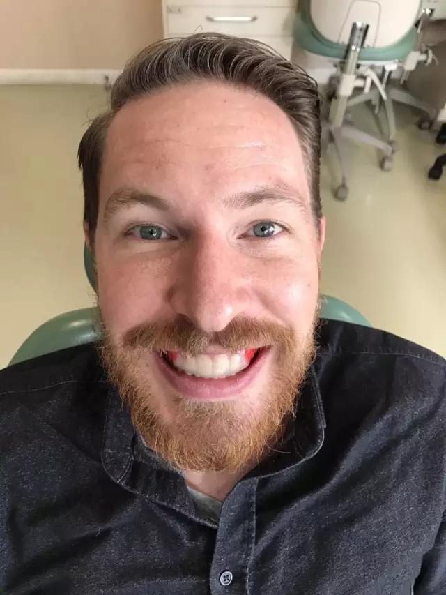 谷爱凌比赛时嘴里含的是什么“秘密*器武**”？