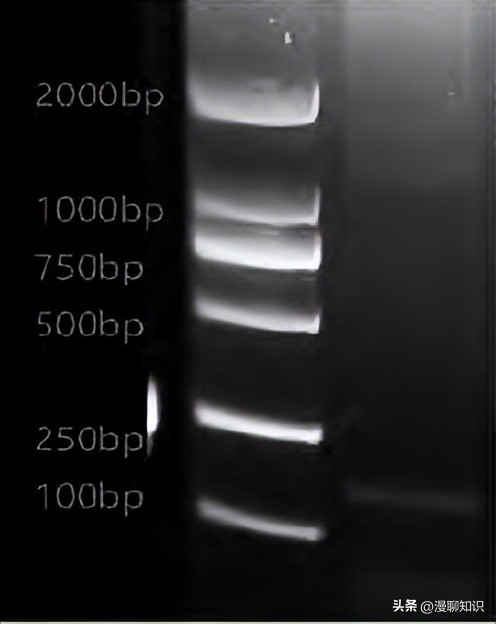 猫会感染人的疾病的图片,猫病毒检测cpr可以测出什么病毒