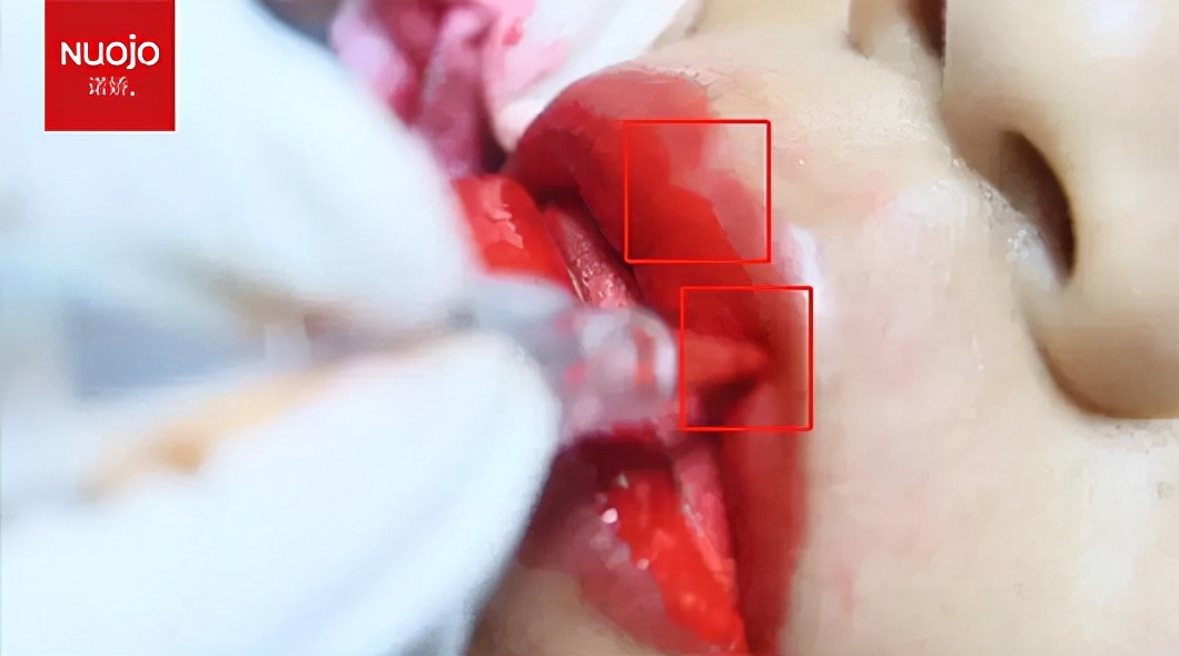 纹唇技巧,纹唇技巧和手法视频流程