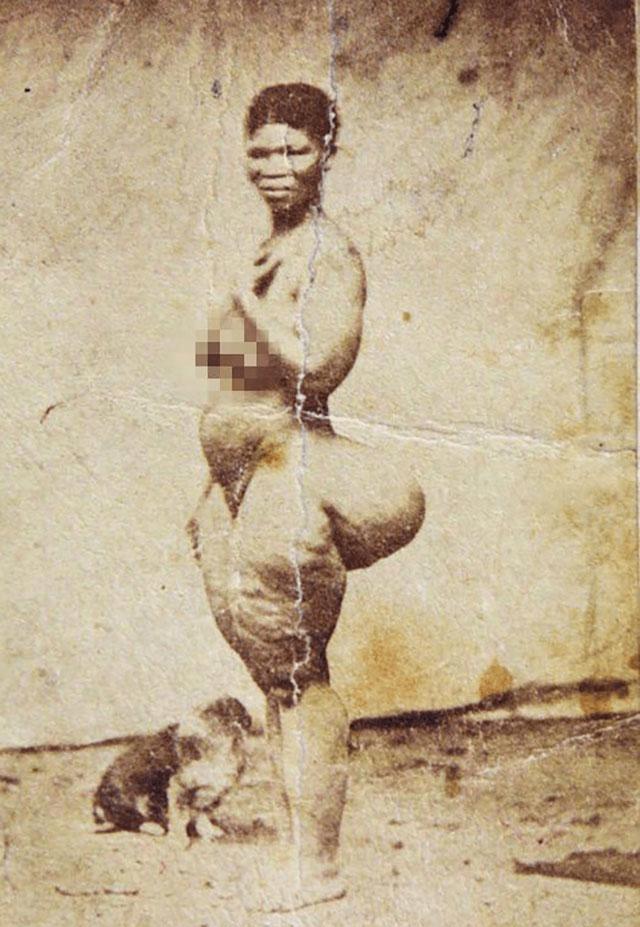 南非少女巴特曼照片,南非萨拉巴特曼标本