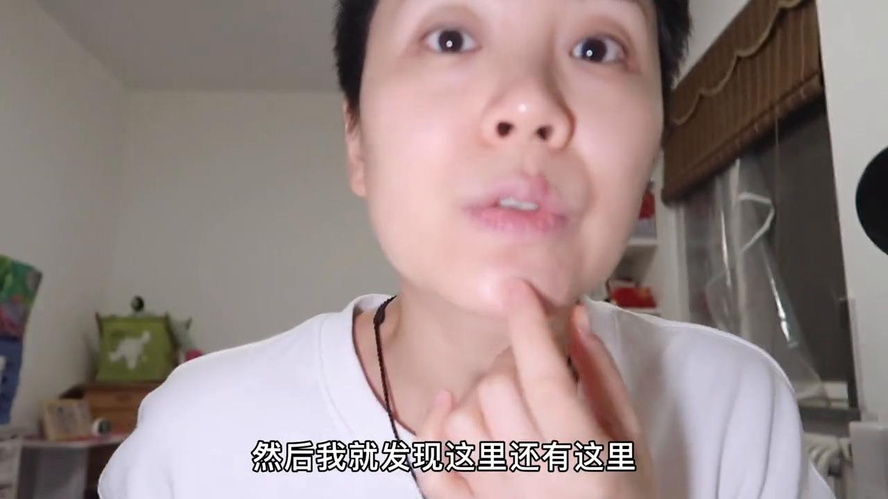 月见草吃了长痘痘什么原因,吃月见草为什么皮肤会好