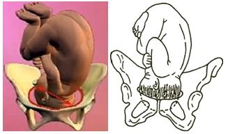 胎儿屁股在右侧是什么胎位,胎位roa屁股在左边还是右边