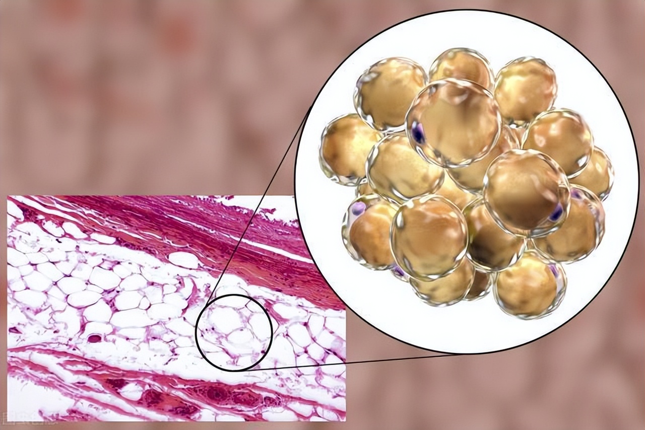 脾虚寒湿针灸能治好吗,针灸对脾虚型肥胖有用吗